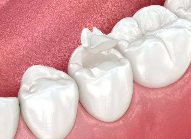 Our Range of Dental Services in Forest City, FL